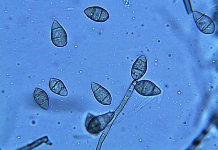 Photo shows close-up of spores of the rice blast fungus, an extremely destructive rice pathogen. Developing rice strains that can resist infection by the fungus is an active area of research.