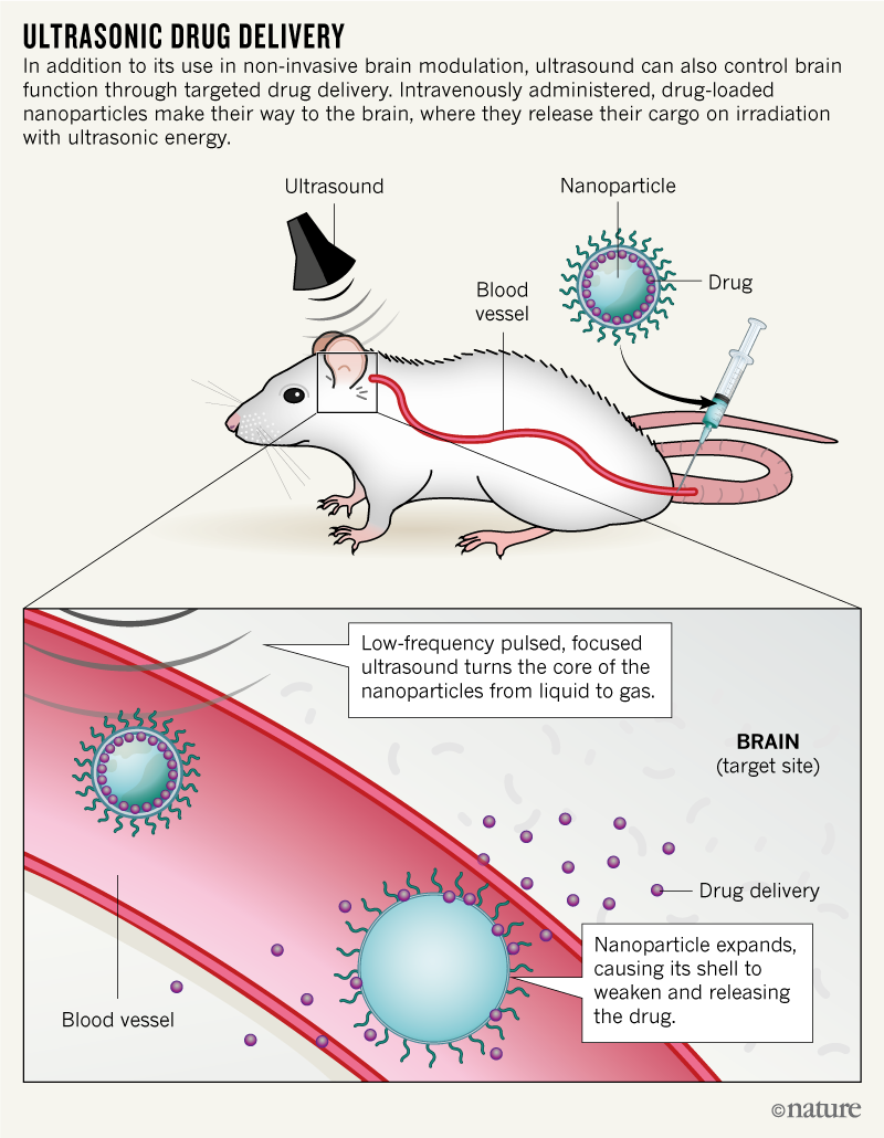 Graphic shows how ultrasound can trigger the release of a drug in a specific spot in the brain of a rat.