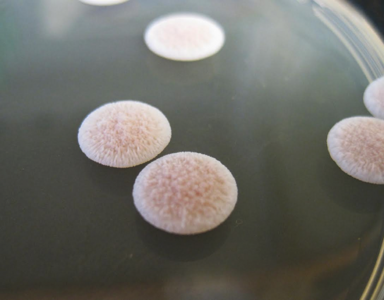 Colonies of yeast growing on a lab plate.
