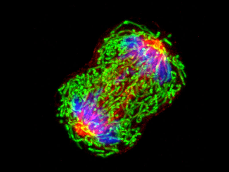 Light-microscope image of a dividing breast cancer cell, showing chromosomes, the tubules that pull chromosomes to the poles and mitochondria.