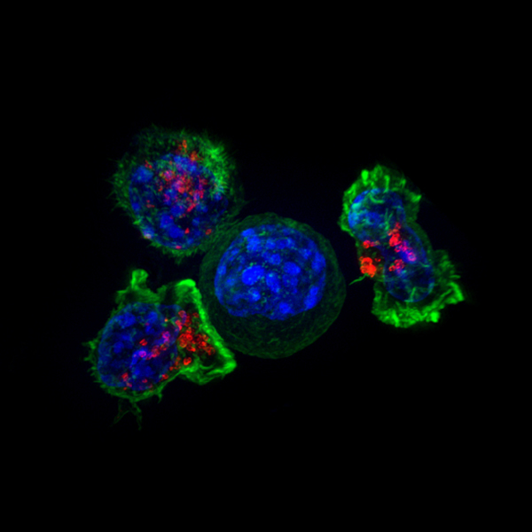 Non-engineered killer T cells surround a cancer cell, preparing to destroy it