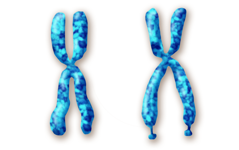 Children with fragile X syndrome carry X chromosomes with an abnormality at the tip of one of the chromosome arms, as shown in an illustration. This affects a gene called FMR1, which carries instructions for a protein important for brain activity, such that little or no protein is made. Fragile X is associated with a range of developmental disabilities, often including autism.
