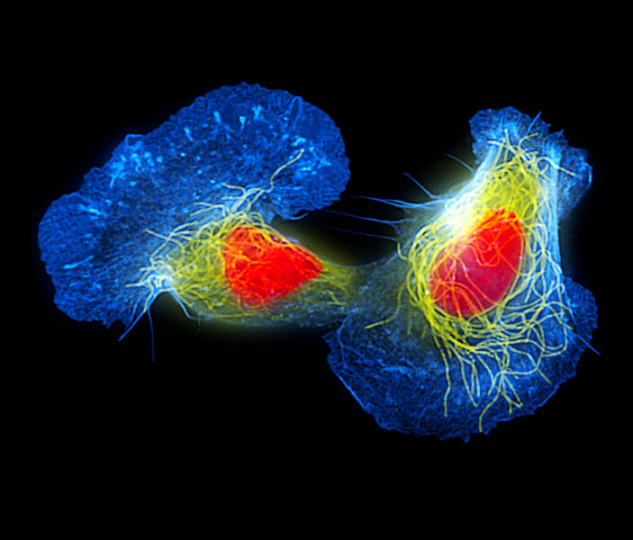 Brightly colorized photograph of two cells, with structures colored blue, yellow and orange.