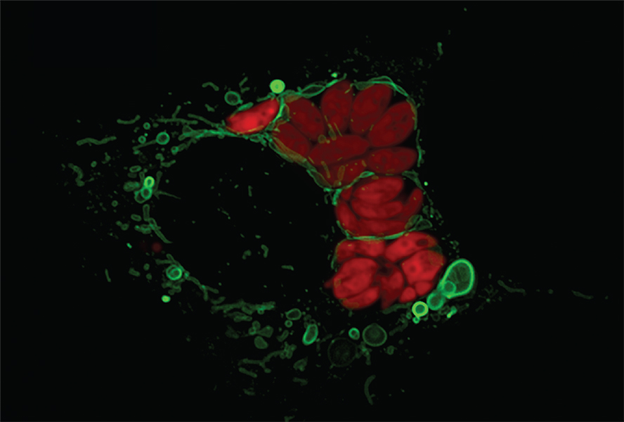 Microscopic image shows large blobs of red and smaller green blobs. The green are mitochondria. Small, green vesicles are being released.