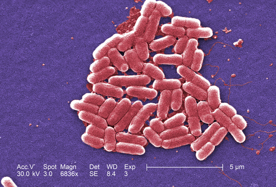 Micrograph of E. coli 0157:H7 bacteria that cause serious fooARrne illness.