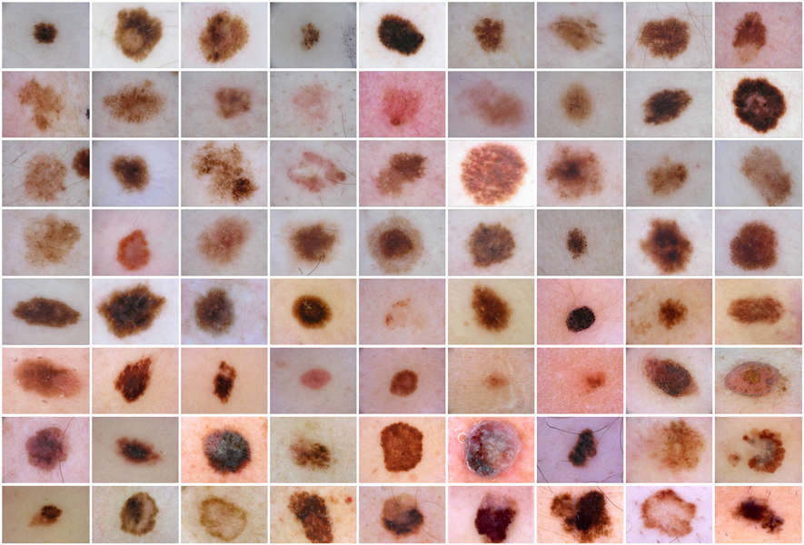 A grid of skin lesions, some of which are benign and some of which are malignant. Deep neural nets “learn” to distinguish the two classes after exposure to many such images.
