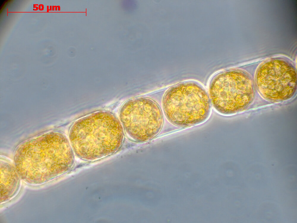 M. arctica A magnified photo of the alga M. arctica in a chain formation