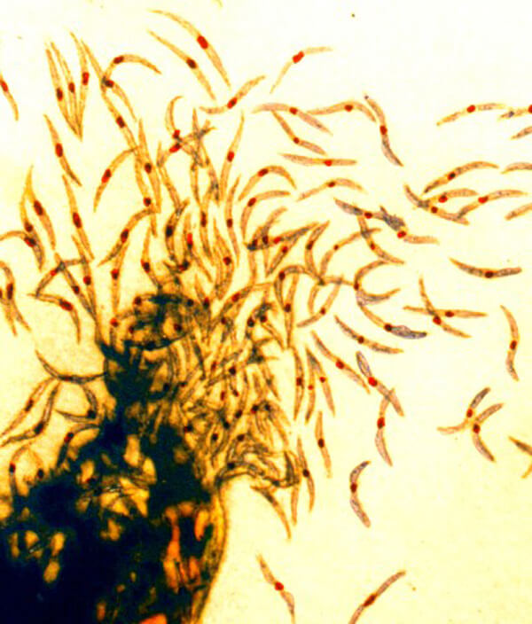 Malaria parasite in the form of sporozoites, which is carried by mosquitoes.