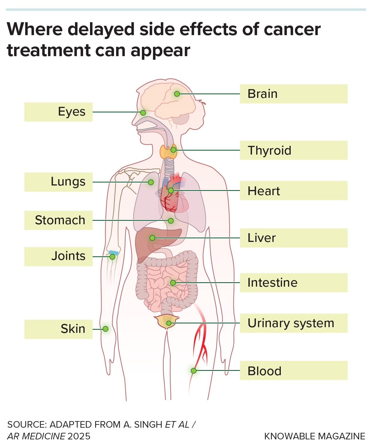 Delayed side effects Drawing of human body showing where delayed side effects of cancer treatment can appear