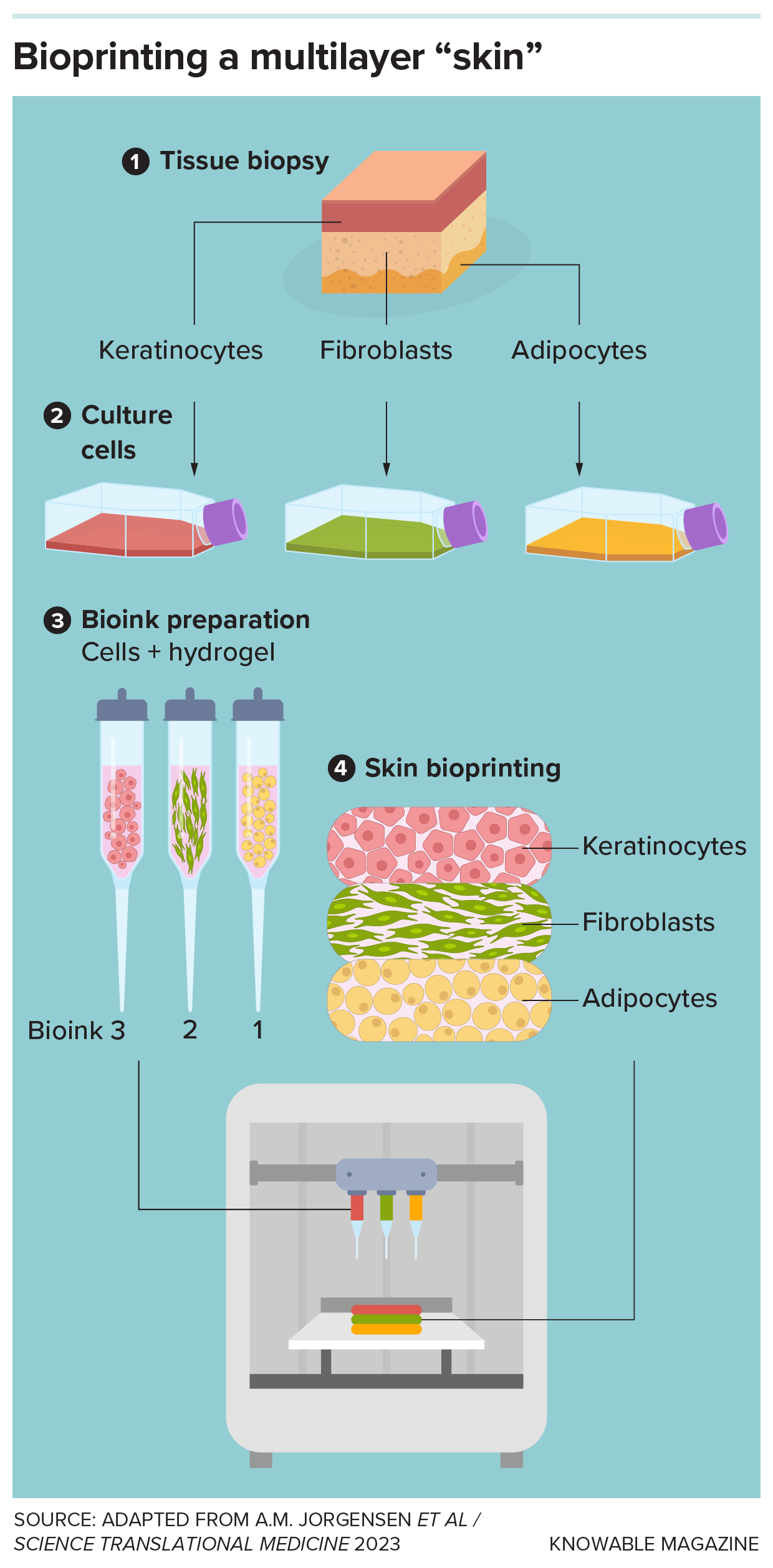 Bioprinting basics Graphic shows the steps to print a three-layer skin