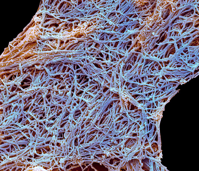 Collagen fibers A tangled mass of fibers
