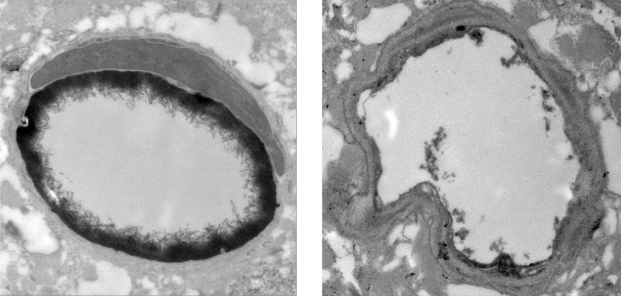 Blood-brain-barrier Electron microscope images show two images of circular capillaries, side by side. The inner lining of the capillary on the left is thicker.