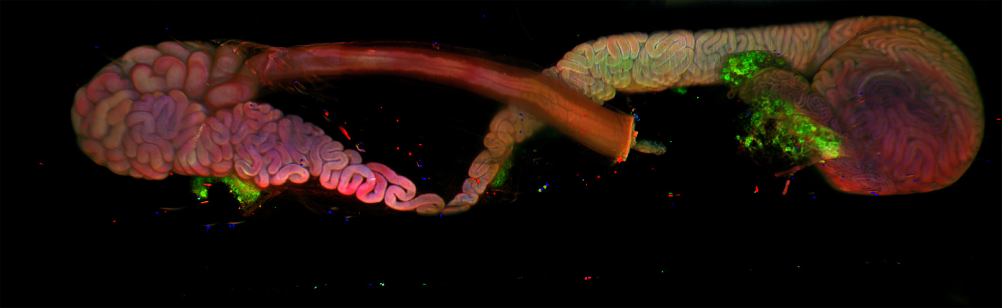 Epididymis Photograph of the epididymis